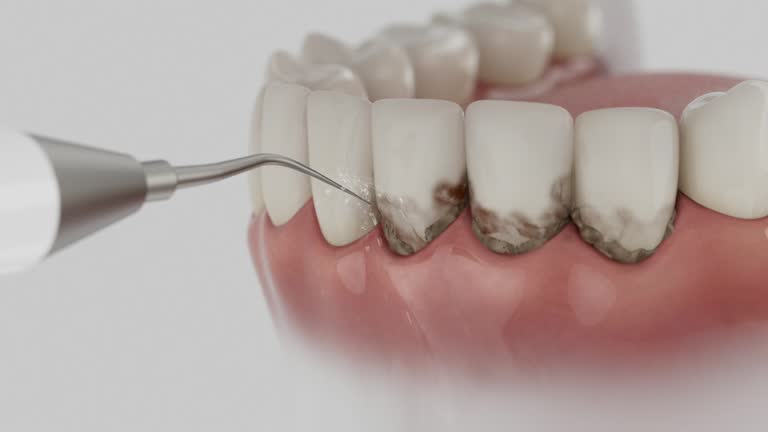 Reliable Emergency Dentist contractor in Mallory, WV by Smile Center Dentistry